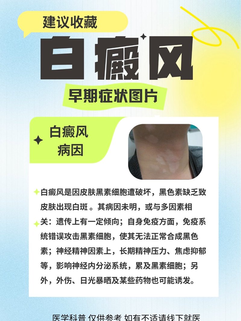 在2025年，面对白癜风这一令人困扰的皮肤病，我们整理了一份详细的治疗指南。这份指南不仅涵盖了最新的治疗方法，还结合了实际案例分析，帮助患者和家属更好地了解如何应对这一疾病。