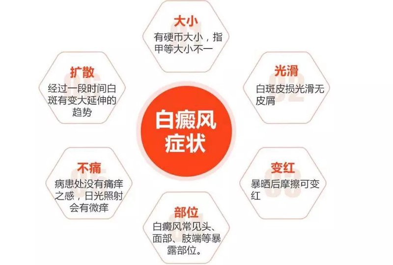 白癜风治疗，你还在迷茫吗？2025版治疗指南来啦！