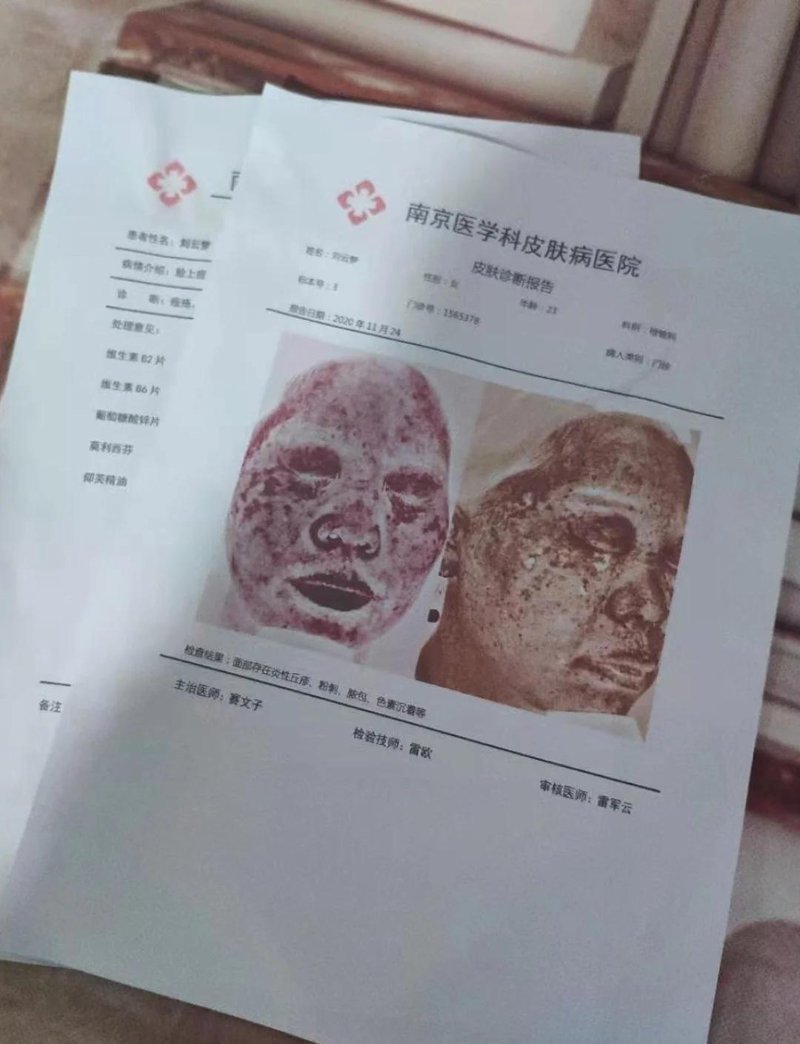 如何战胜白癜风？2025版治疗指南
